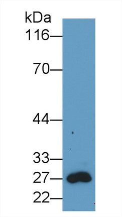 Green Fluorescent Protein (GFP) Monoclonal Antibody, CAU30797