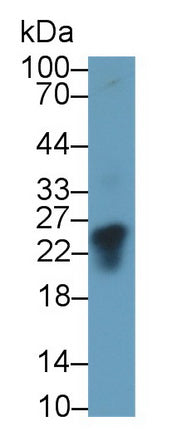 Chorionic Gonadotropin Beta Polypeptide (CGb) Monoclonal Antibody, CAU30803