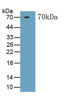 Troponin T Type 2, Cardiac (TNNT2) Monoclonal Antibody, CAU30805
