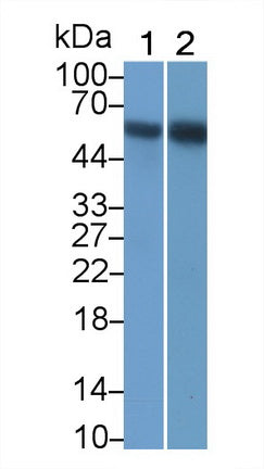 Receptor Interacting Serine Threonine Kinase 3 (RIPK3) Monoclonal Antibody, CAU30815