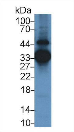 Annexin A3 (ANXA3) Monoclonal Antibody, CAU30818