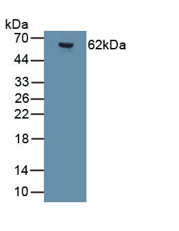 Glutamate Receptor, Ionotropic, AMPA 2 (GRIA2) Monoclonal Antibody, CAU30819