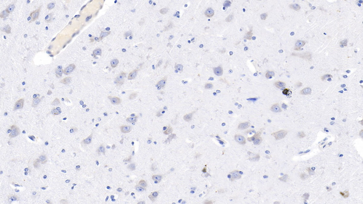 DAB staining on IHC-P; Samples: Human Cerebrum Tissue;  Primary Ab: 10µg/ml Mouse Anti-Human GRIN2B Antibody Second Ab: 2µg/mL HRP-Linked Caprine Anti-Mouse IgG Polyclonal Antibody 