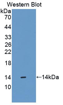 T-Kininogen 1 (KNT1) Monoclonal Antibody, CAU30839