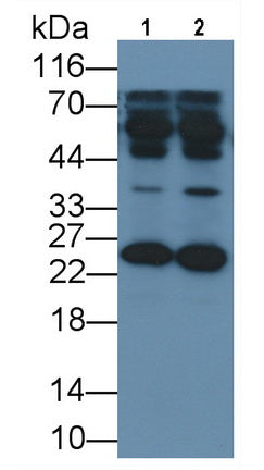 Parkinson Disease Protein 7 (PARK7) Monoclonal Antibody, CAU30844
