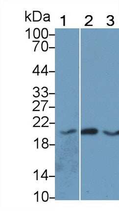 Angiopoietin Like Protein 8 (ANGPTL8) Monoclonal Antibody, CAU30848