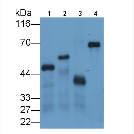 Glutathione S Transferase (GST) Monoclonal Antibody, CAU30849