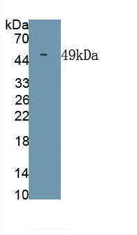 Chikungunya Virus (CHIKV) Monoclonal Antibody, CAU30851