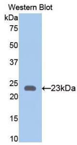 Bone Morphogenetic Protein 4 (BMP4) Polyclonal Antibody, CAU30861
