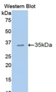 Western Blot; Sample: Recombinant CDHE, Human.