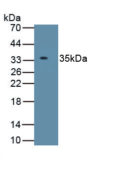 Insulin Like Growth Factor Binding Protein 2 (IGFBP2) Polyclonal Antibody, CAU30886