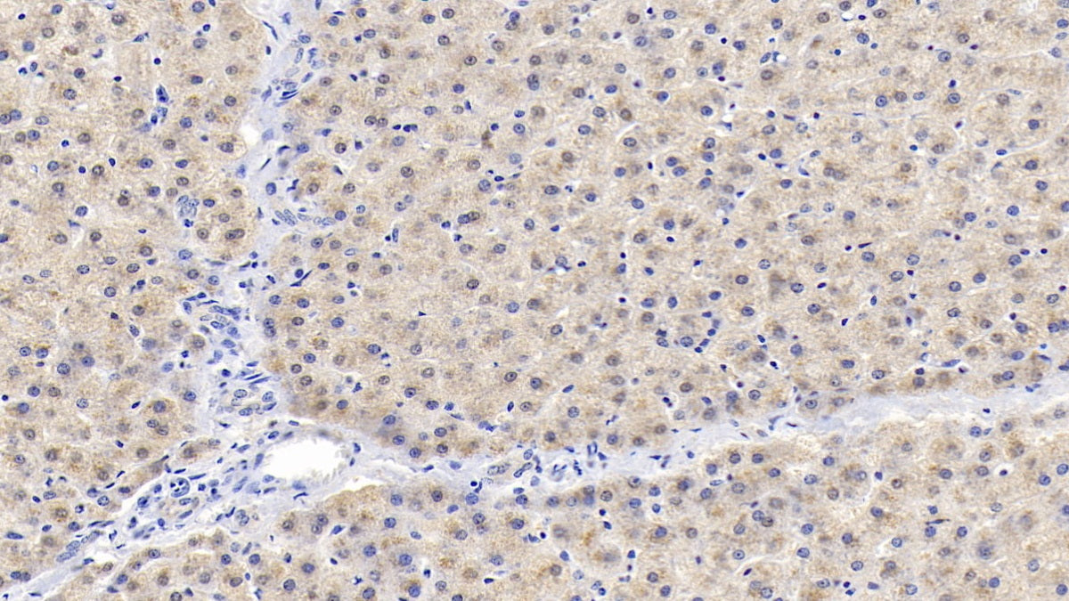 DAB staining on IHC-P; Samples: Porcine Liver Tissue; Primary Ab: 20µg/ml Rabbit Anti-Porcine IGFBP2 Antibody Second Ab: 2µg/mL HRP-Linked Caprine Anti-Rabbit IgG Polyclonal Antibody