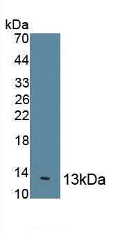 Interleukin 8 (IL8) Polyclonal Antibody, CAU30919