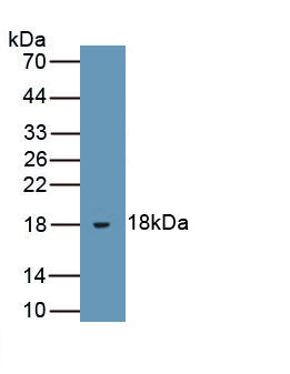Leptin (LEP) Polyclonal Antibody, CAU30925