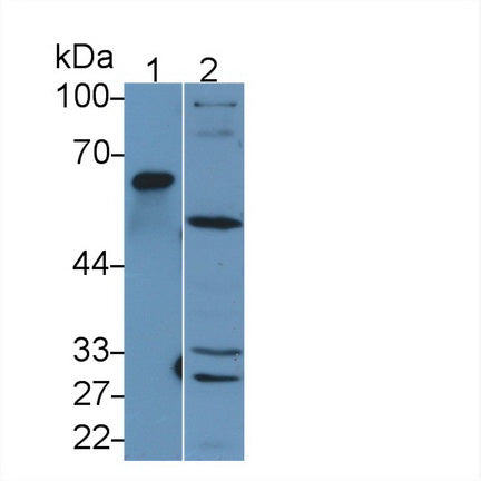 Matrix Metalloproteinase 1 (MMP1) Polyclonal Antibody, CAU30935