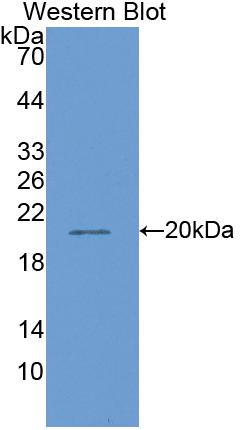 Matrix Metalloproteinase 13 (MMP13) Polyclonal Antibody, CAU30936