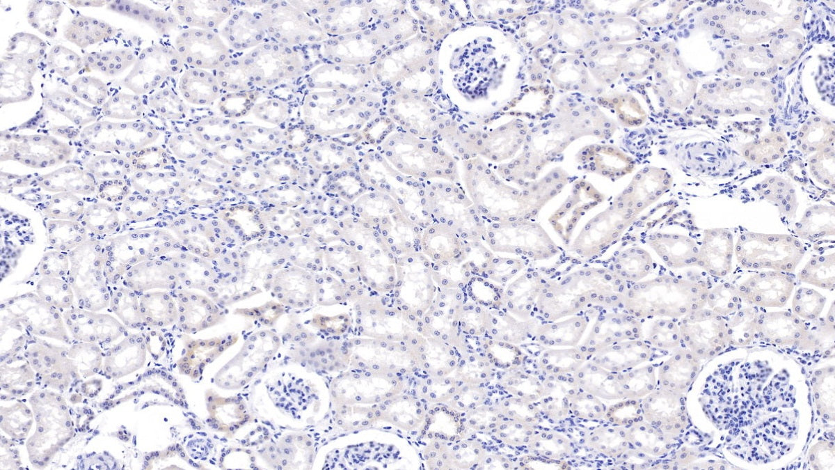 DAB staining on IHC-P; Samples: Bovine Kidney Tissue;  Primary Ab: 20µg/ml Rabbit Anti-Bovine MMP7 Antibody Second Ab: 2µg/mL HRP-Linked Caprine Anti-Rabbit IgG Polyclonal Antibody 