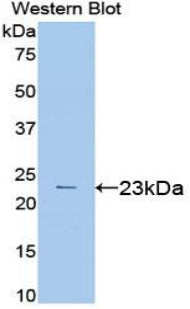 Vascular Endothelial Growth Factor A (VEGFA) Polyclonal Antibody, CAU30963