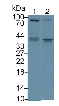 Vascular Endothelial Growth Factor D (VEGFD) Polyclonal Antibody, CAU30967