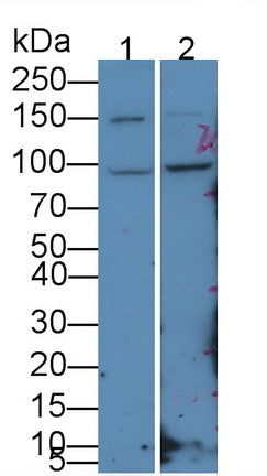 Carcinoembryonic Antigen (CEA) Polyclonal Antibody, CAU30970