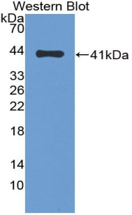 Monocyte Chemotactic Protein 4 (MCP4) Polyclonal Antibody, CAU30987