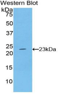 Interferon Beta (IFNb) Polyclonal Antibody, CAU30998