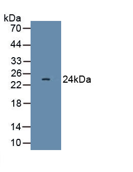 Interferon Beta (IFNb) Polyclonal Antibody, CAU30999