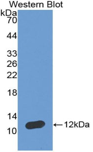 Atrial Natriuretic Peptide (ANP) Polyclonal Antibody, CAU31003