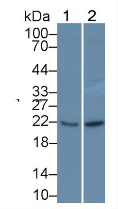 Glutathione Peroxidase 1 (GPX1) Polyclonal Antibody, CAU31029