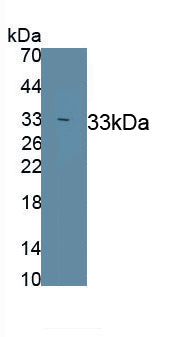 Neuronal Pentraxin II (NPTX2) Polyclonal Antibody, CAU31031