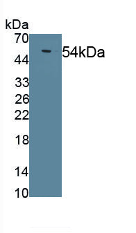 Lipoprotein lipase (LPL) Polyclonal Antibody, CAU31046