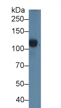 Complement Component 5a (C5a) Polyclonal Antibody, CAU31049
