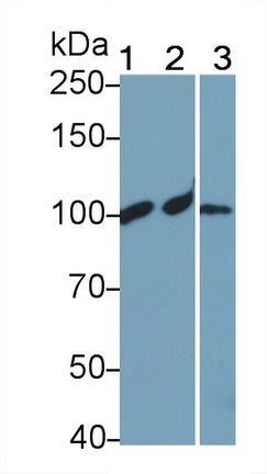 Complement Component 4a (C4a) Polyclonal Antibody, CAU31050