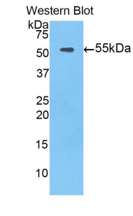 Tissue Factor Pathway Inhibitor (TFPI) Polyclonal Antibody, CAU31053