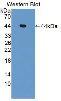 Sjogren Syndrome Antigen A2 (SSA2) Polyclonal Antibody, CAU31642