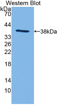 Myosin IF (MYO1F) Polyclonal Antibody, CAU31658
