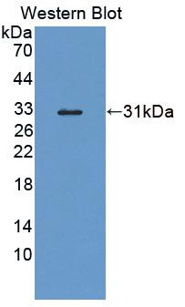 Protein Tyrosine Phosphatase, Non Receptor Type 2 (PTPN2) Polyclonal Antibody, CAU31666