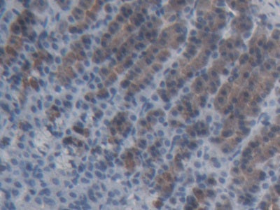 DAB staining on IHC-P; Samples: Rat Stomach Tissue;  Primary Ab: 20µg/ml Rabbit Anti-Rat ABCC11 Anti