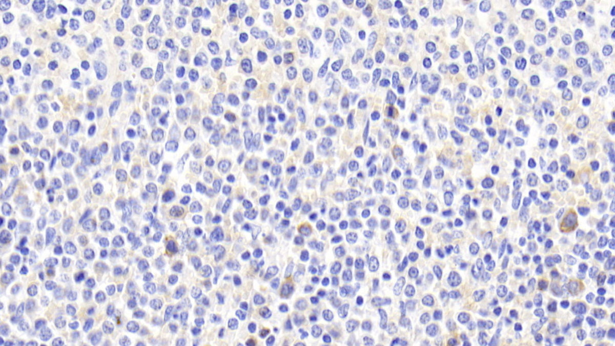 DAB staining on IHC-P; Samples: Human Spleen Tissue; Primary Ab: 20μg/ml Rabbit Anti-Human ABCA7 Antibody Second Ab: 2µg/mL HRP-Linked Caprine Anti-Rabbit IgG Polyclonal Antibody