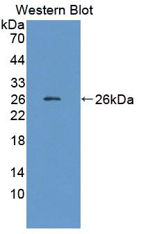 Coenzyme A Synthase (COASY) Polyclonal Antibody, CAU31675