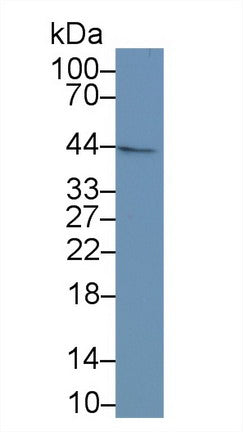 Runt Related Transcription Factor 1 (RUNX1) Polyclonal Antibody, CAU31681