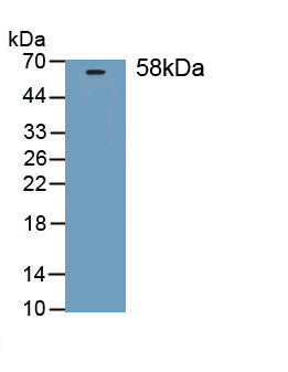 Thrombospondin 3 (THBS3) Polyclonal Antibody, CAU31690