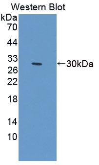 Phospholipase C Delta 1 (PLCd1) Polyclonal Antibody, CAU31691
