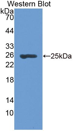 Branched Chain Aminotransferase 2, Mitochondrial (BCAT2) Polyclonal Antibody, CAU31695