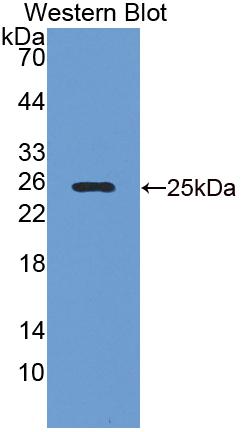 Tumor Necrosis Factor Receptor Superfamily, Member 25 (TNFRSF25) Polyclonal Antibody, CAU31701