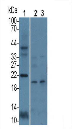 Calcyon Neuron Specific Vesicular Protein (CALY) Polyclonal Antibody, CAU31714