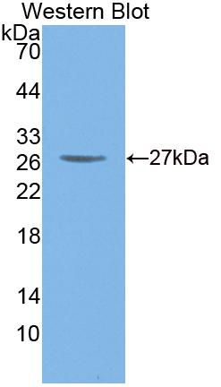 Cathepsin O (CTSO) Polyclonal Antibody, CAU31717