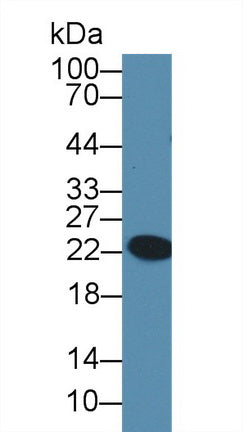 Glutathione Peroxidase 6, Olfactory (GPX6) Polyclonal Antibody, CAU31718