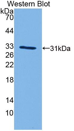 Cyclic AMP Response Element Binding Protein 5 (CREB5) Polyclonal Antibody, CAU31719