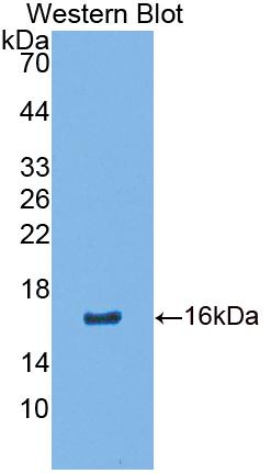 Calcium Binding Protein 2 (CABP2) Polyclonal Antibody, CAU31721